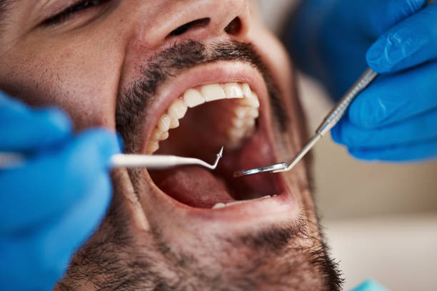 Best Urgent Tooth Repair  in Loganville, PA